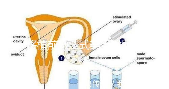 移植前做法式美甲對著床影響不少,別以為貼甲片就沒事了