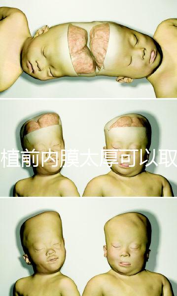 移植前內(nèi)膜太厚可以取卵早知道，疼痛因人而異