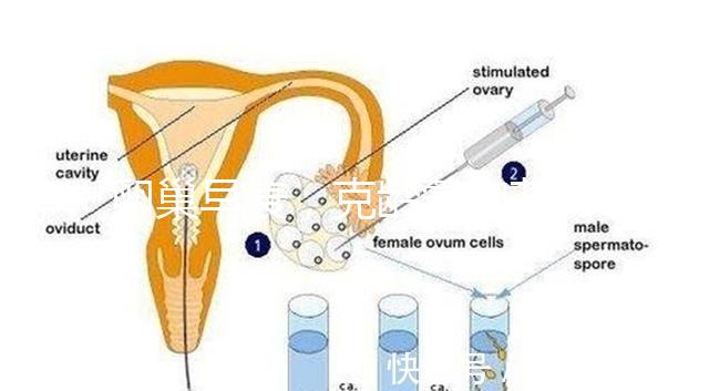 卵巢早衰，克齡蒙和芬嗎通藥物選擇引爭議