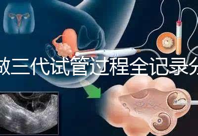 做三代試管過程全記錄分享(北醫三院)