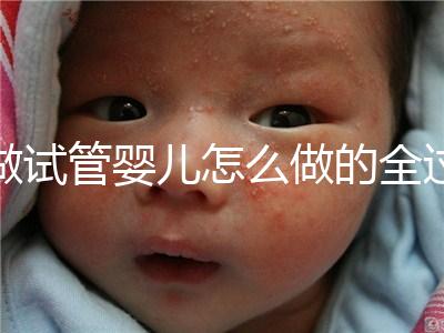 做試管嬰兒怎么做的全過(guò)程(做試管嬰兒怎么做的全過(guò)程視頻)