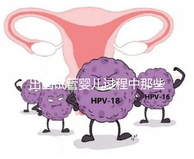 出國試管嬰兒過程中那些困惑，12個常見問題釋疑