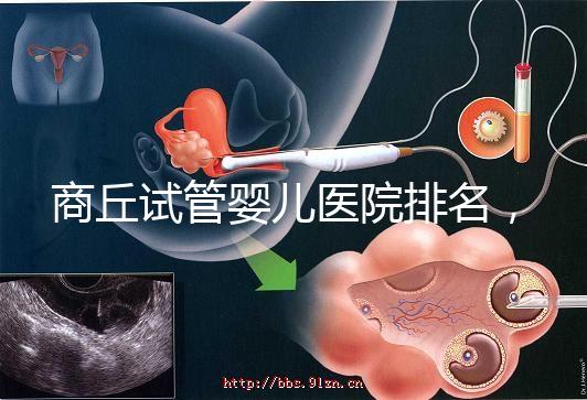 商丘試管嬰兒醫(yī)院排名,附3家公立機構助孕成功率和費用