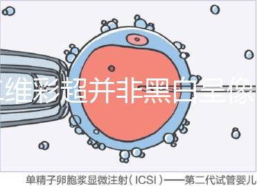 二維彩超并非黑白呈像，通過(guò)檢查還能看清胎兒五官