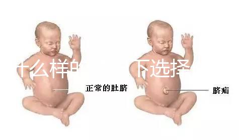 什么樣的情況下選擇做試管嬰兒？