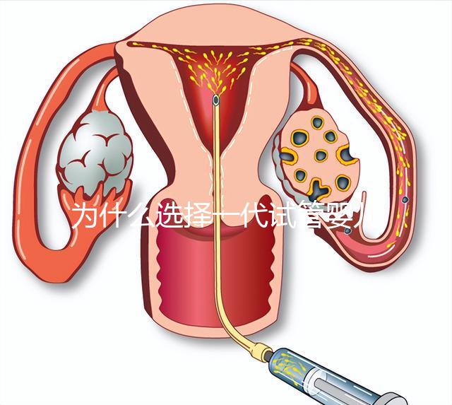 為什么選擇一代試管嬰兒?全面解析其獨(dú)特優(yōu)勢(shì)與適用場(chǎng)景
