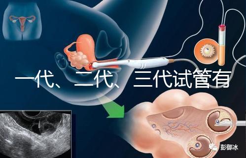 一代、二代、三代試管有什么區別？