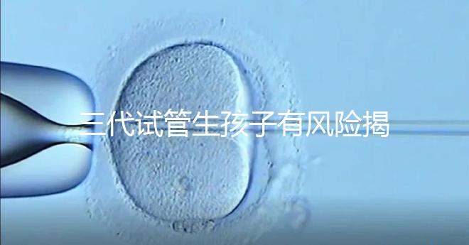 三代試管生孩子有風(fēng)險(xiǎn)揭秘嗎？嬰兒會有問題嗎？