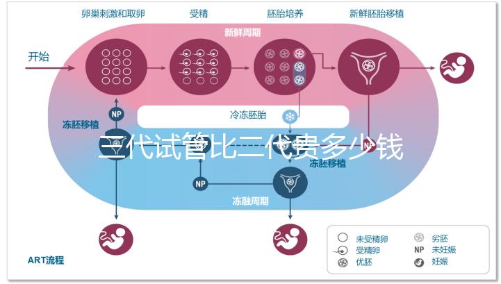 三代試管比二代貴多少錢?2025最新費(fèi)用明細(xì)解析