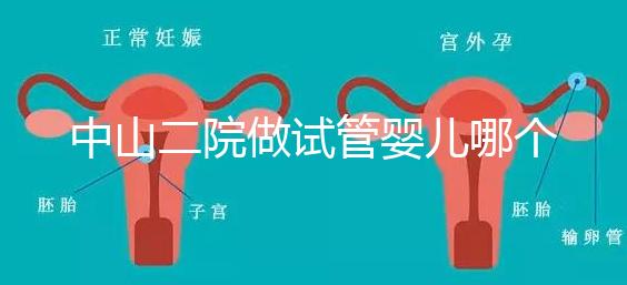 中山二院做試管嬰兒哪個醫生好？附醫院試管成功率