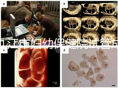 九江市婦幼保健院試管成功率高、費用低？生殖醫(yī)生揭開真相