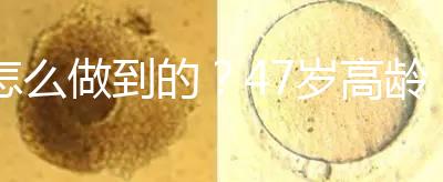 怎么做到的？47歲高齡試管嬰兒唯一男胚一次移植成功！