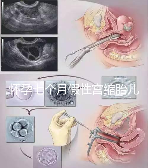 懷孕七個月假性宮縮胎兒可能缺氧，處理不好對胎兒影響大