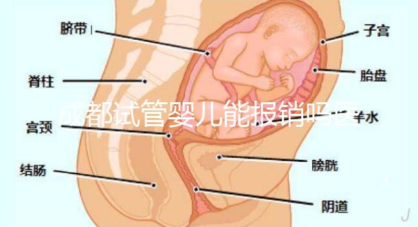成都試管嬰兒能報銷嗎醫保？政策解讀