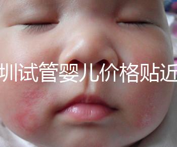 深圳試管嬰兒價格貼近百姓！三代試管只需8