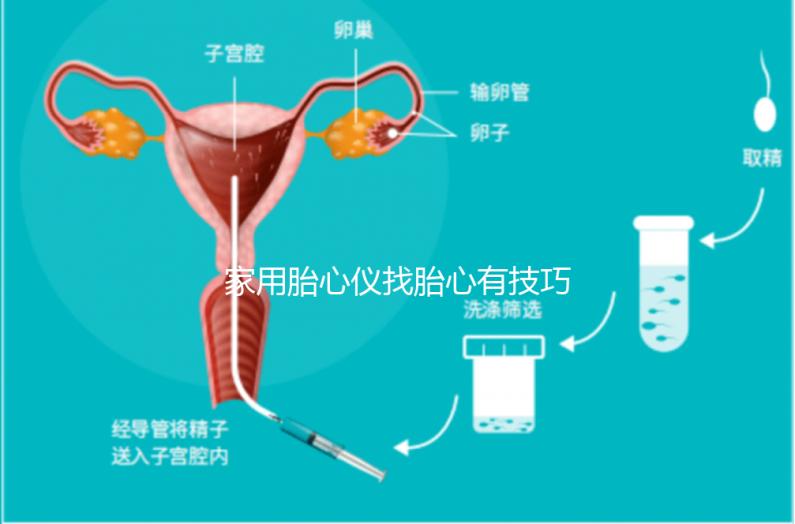 家用胎心儀找胎心有技巧，飯后半個小時測準確率稍高