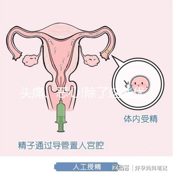 頭痛、惡心!除了這些優(yōu)思明副作用還有哪些