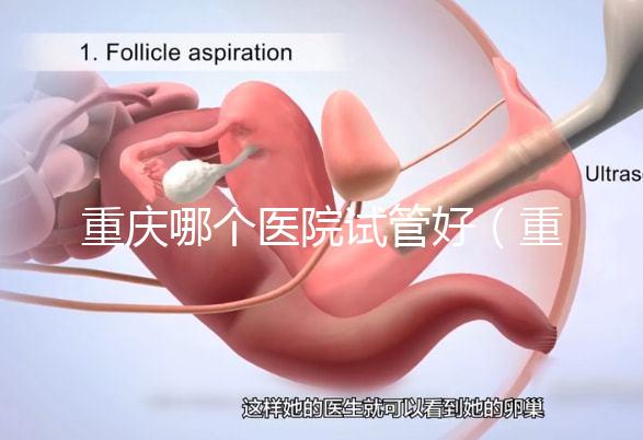 重慶哪個醫(yī)院試管好(重慶哪個醫(yī)院試管好一點)