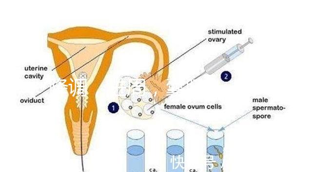 降調(diào)，進(jìn)周，囊胚……這些試管嬰兒助孕術(shù)語你都懂嗎？