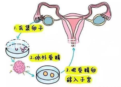 試管嬰兒二超后減藥原因已找到,對(duì)胎兒沒(méi)影響別瞎擔(dān)心