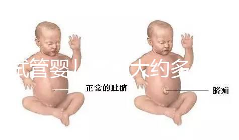 試管嬰兒費(fèi)用大約多少2021年（試管嬰兒費(fèi)用大約多少2021年鄭州）