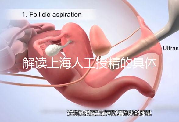 解讀上海人工授精的具體過程，會不會痛看醫(yī)生怎么說？