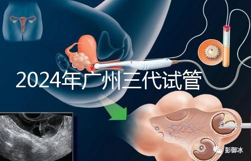 2024年廣州三代試管嬰兒費用明細公布！