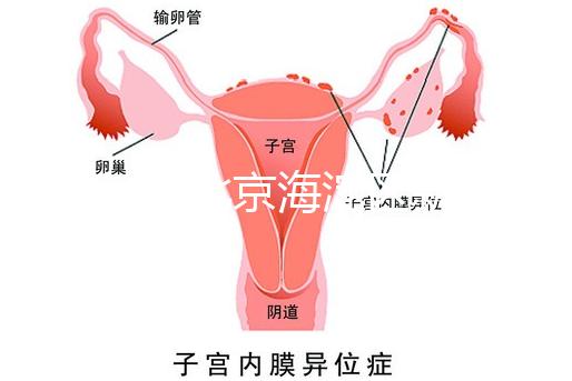 2024年北京海淀區(qū)新生兒醫(yī)療保險處理策略,照片要求不要出錯