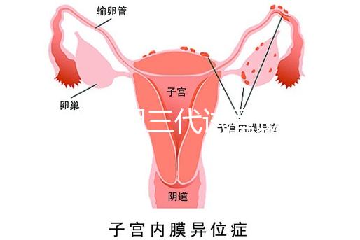 2025昆明三代試管助孕機構收費明細，價格8萬至15萬不等
